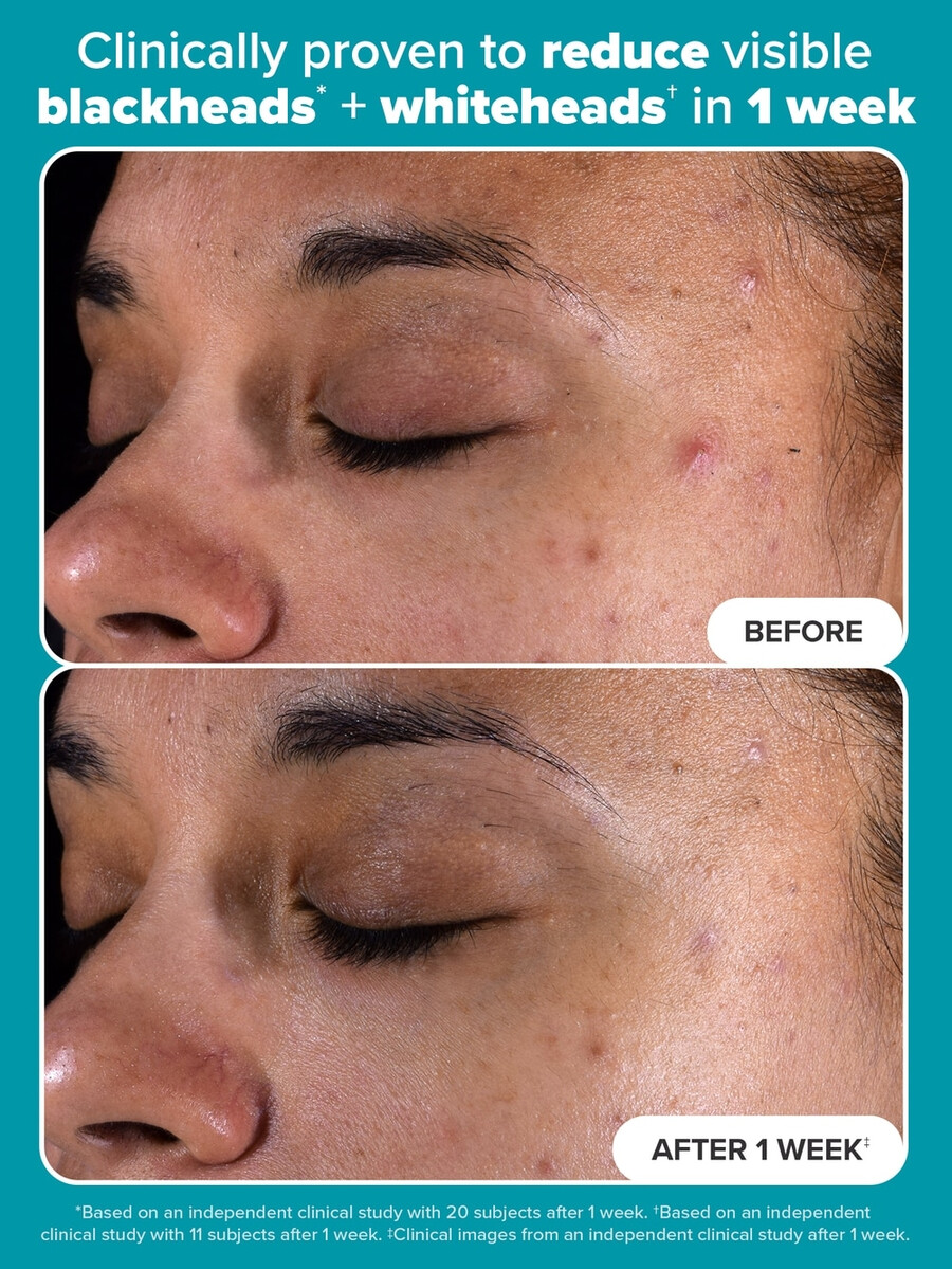 skin perfecting 2 bha liquid exfoliant