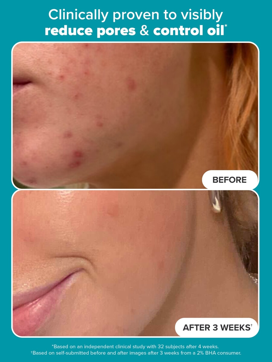 skin perfecting 2 bha liquid exfoliant