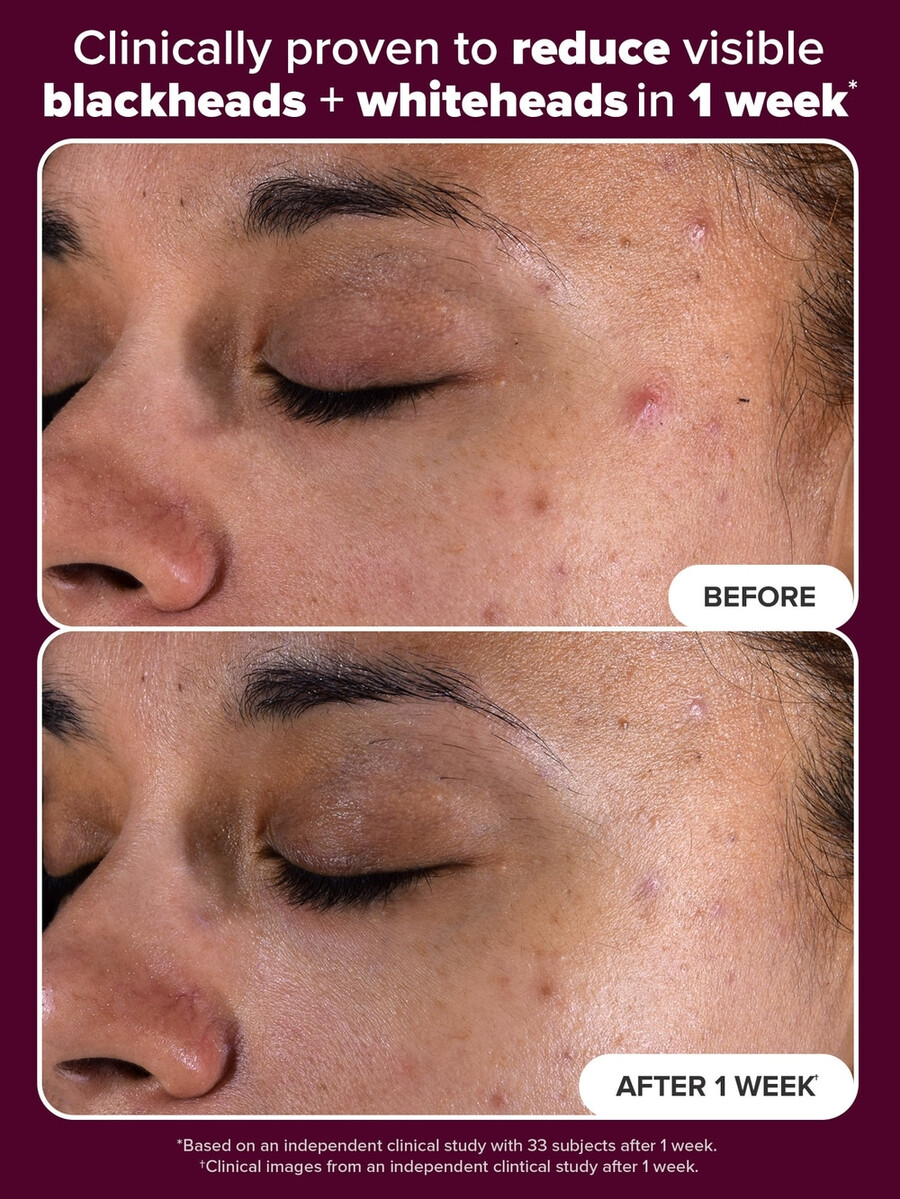 holiday edition 2 bha exfoliating toner