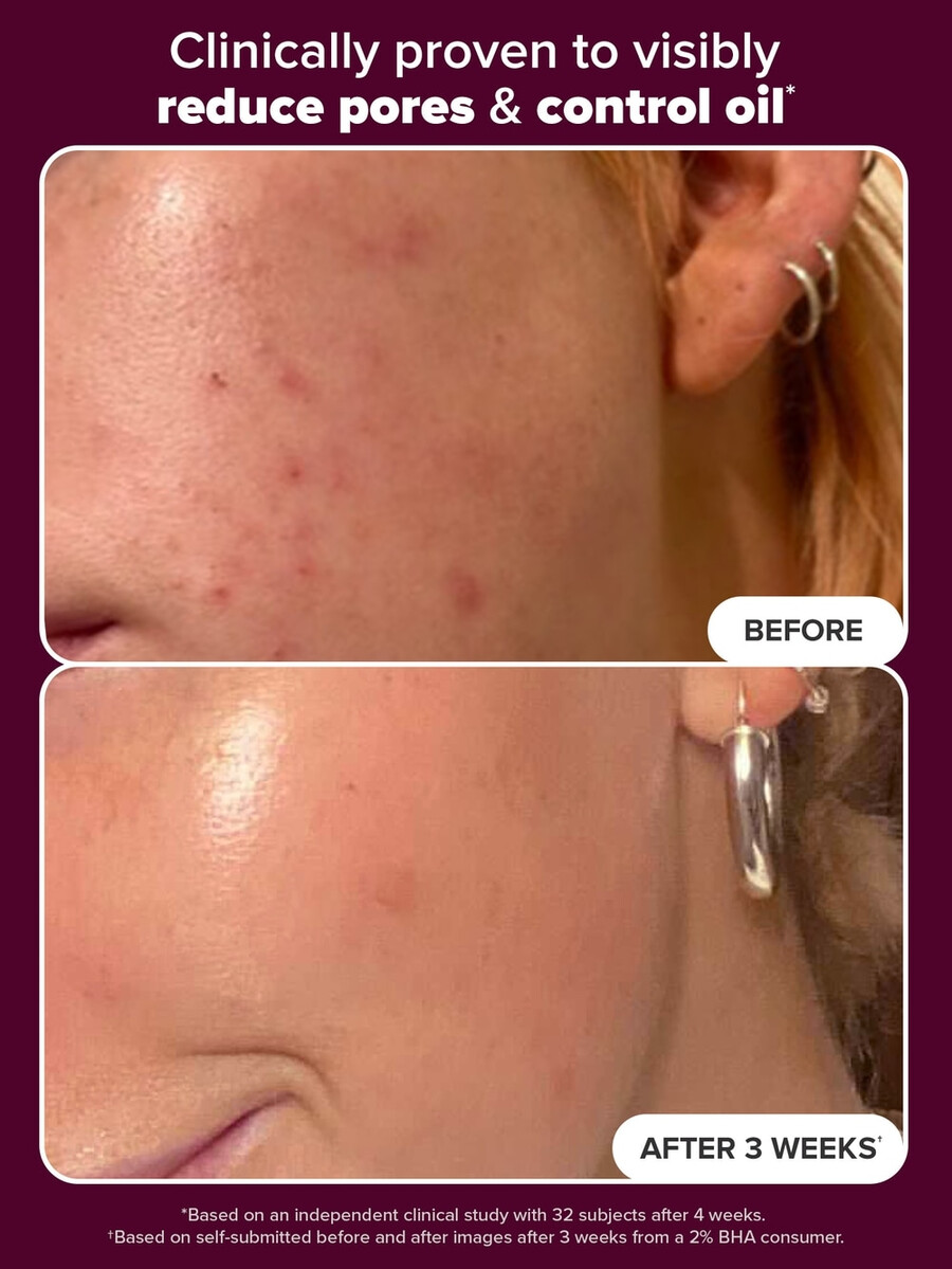 holiday edition 2 bha exfoliating toner