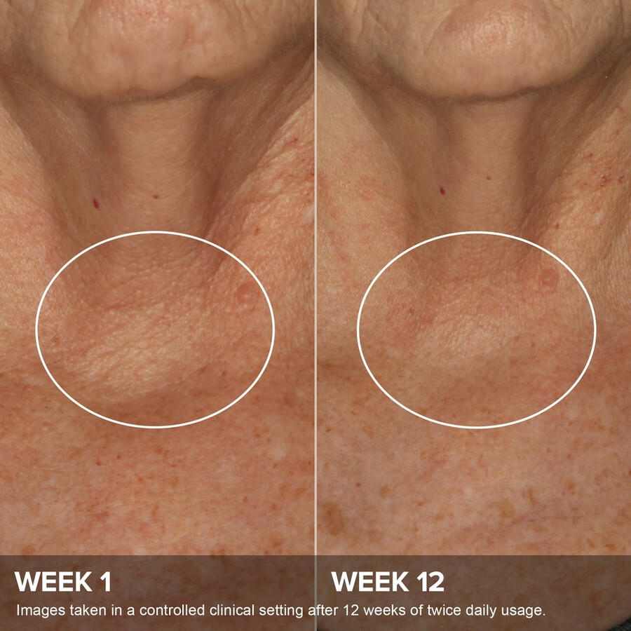 clinical phytoestrogen elasticity renewal body treatment