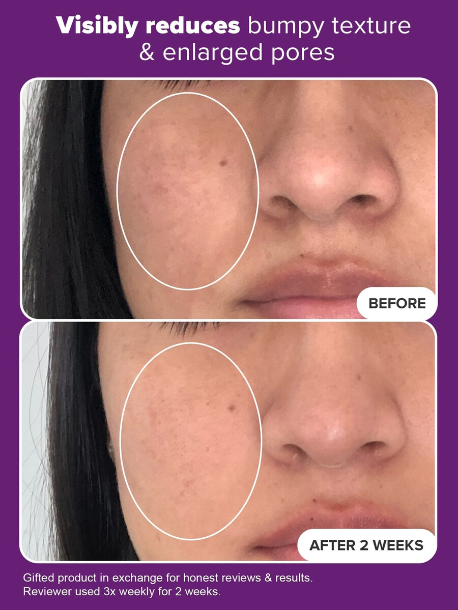 clinical 20 niacinamide serum treatment