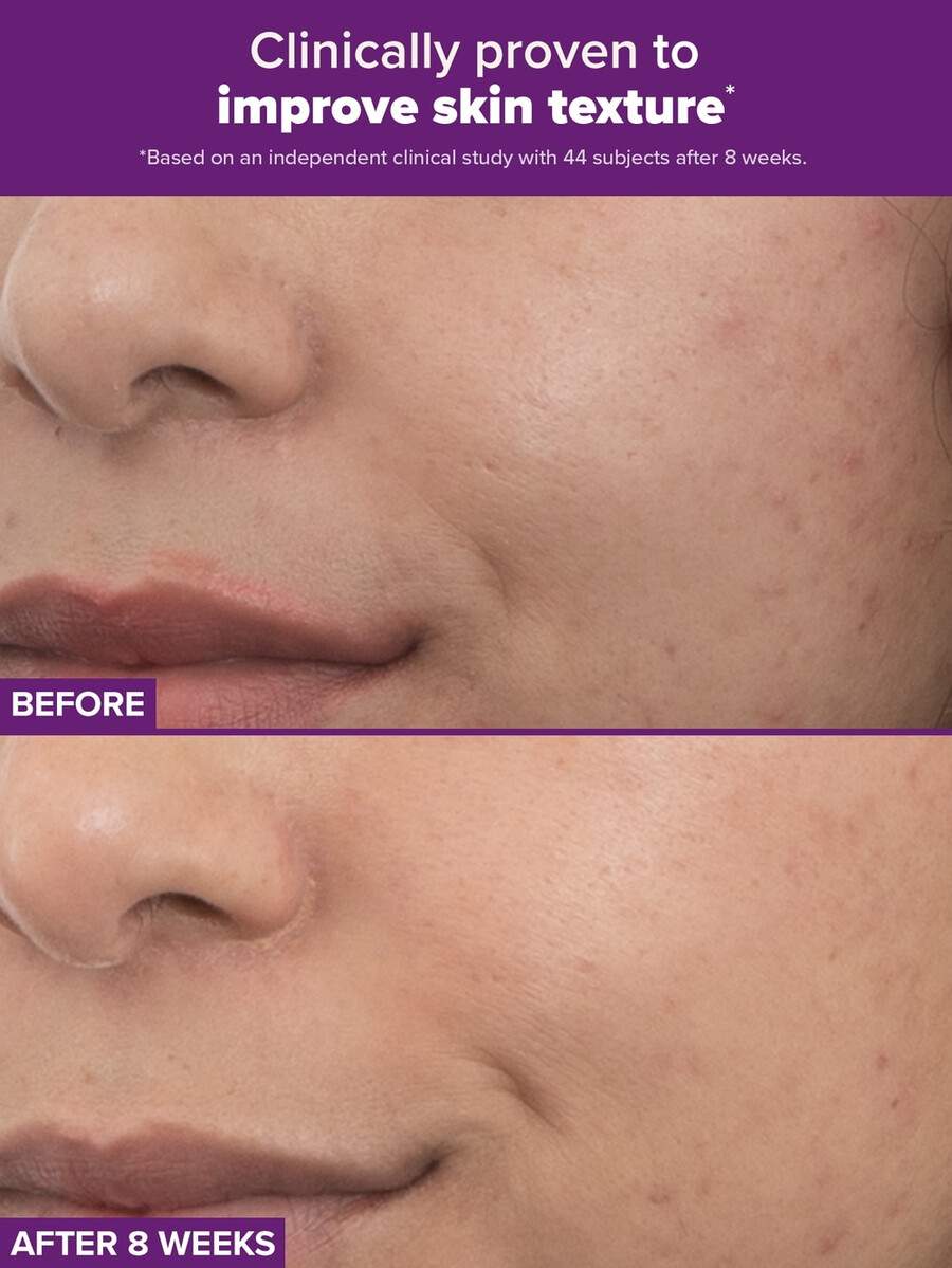 clinical pro retinaldehyde dual-retinoid treatment