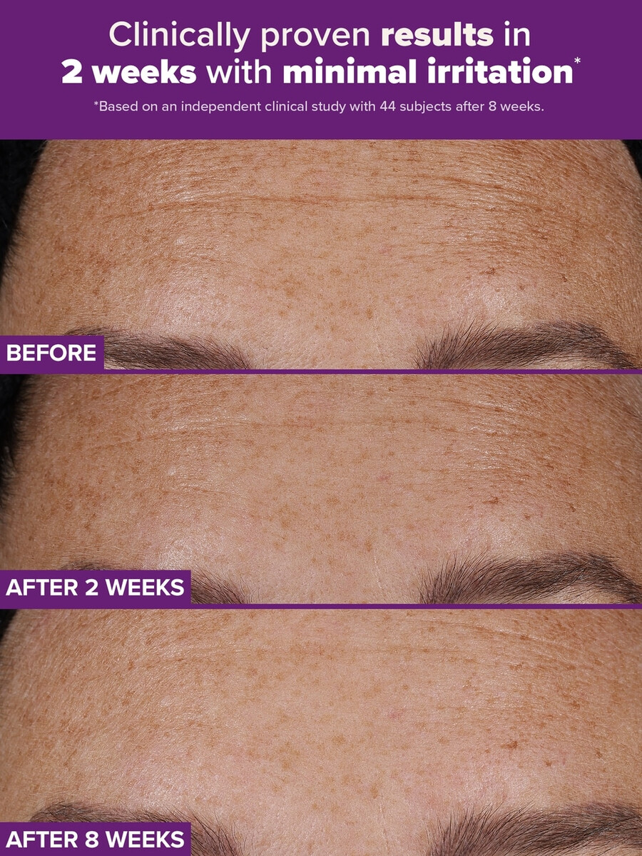 clinical pro retinaldehyde dual-retinoid treatment