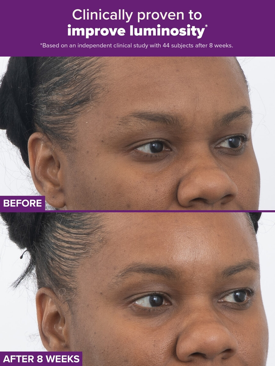 clinical pro retinaldehyde dual-retinoid treatment